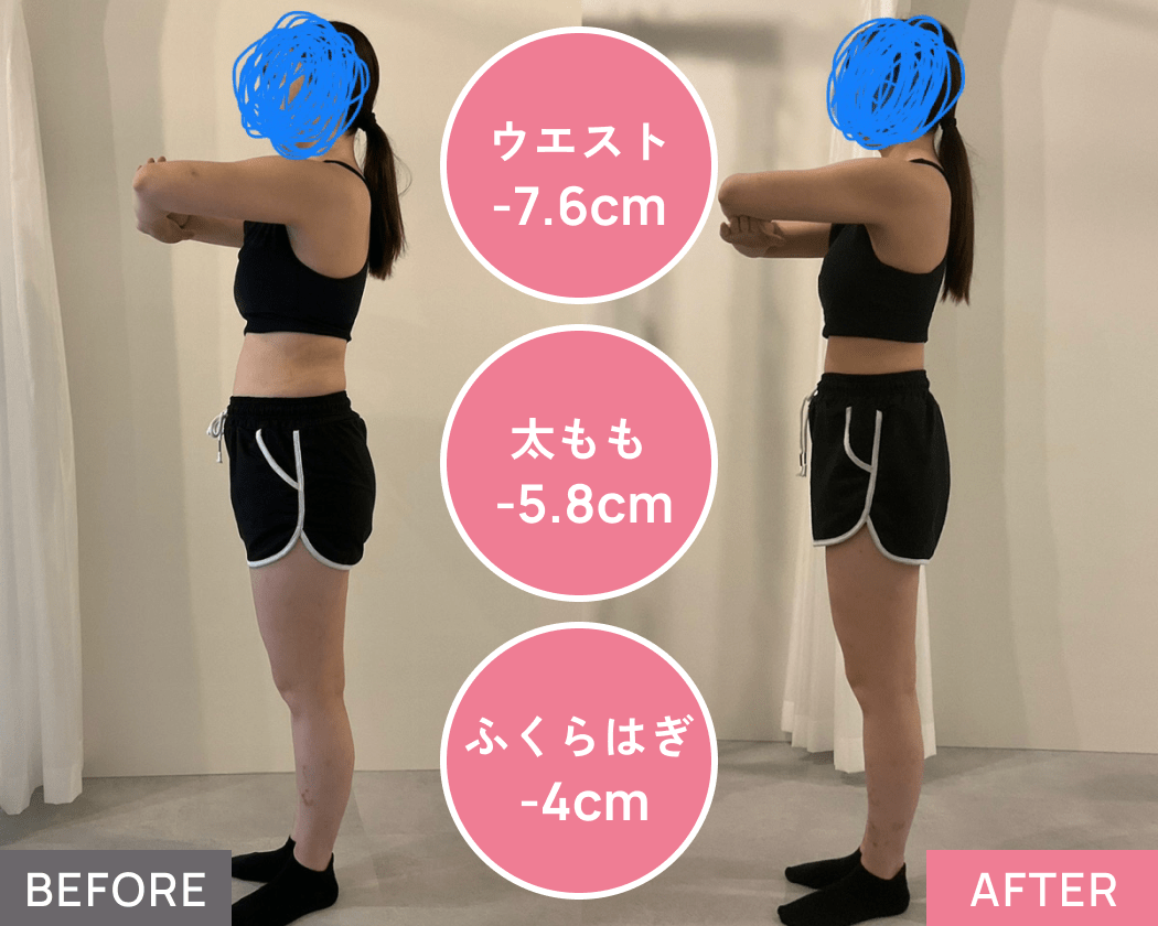 前もも・ふくらはぎのハリ、反り腰、ウエスト